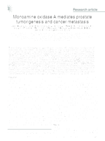 Monoamine oxidase A mediates prostate tumorigenesis and cancer metastasis
