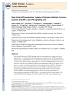 Near-infrared fluorescence imaging of cancer mediated by tumor hypoxia and HIF1α/OATPs signaling axis
