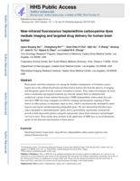 Near-infrared fluorescence heptamethine carbocyanine dyes mediate imaging and targeted drug delivery for human brain tumor